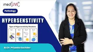 Hypersensitivity by Priyanka Sachdev Ma'am : Unraveling Mechanisms and Clinical Insights