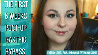 THE FIRST 6 WEEKS POST-OP GASTRIC BYPASS SURGERY | Energy level, pain, and what eating was like!