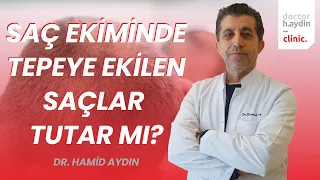 Saç Ekiminde Tepeye Ekilen Saçlar Tutar mı? - Dr. Hamid AYDIN