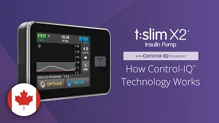 How Control-IQ Technology Works on the t:slim X2 Insulin Pump