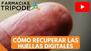 Cómo cuidar las huellas dactilares | ¿Por qué mi celular no reconoce mi huella?