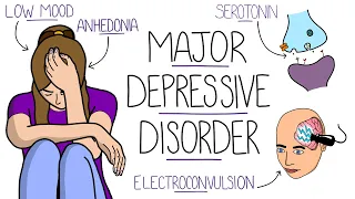 Depression Explained (Major Depressive Disorder)