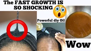 WOW😱MY HAIR GREW SO FAST when I COMBINED ONLY 3 INGREDIENTS & used it everyday other day😱😳