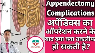 Appendectomy Complications। अपेंडिक्स का ऑपरेशन करने के बाद क्या क्या प्रोब्लेम्स हो सकते है?