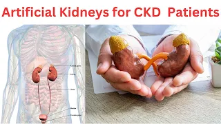 Artificial Kidneys: A Promising Future for Chronic Kidney Disease Patients