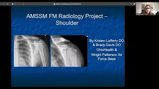Shoulder | MSK Radiology: X-Ray Educational Modules for Primary Care Residents