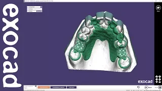 exocad Video Tutorial (basic): Designing a Removable Partial Framework