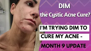 #DIM The Cystic Acne Cure???? Part 9 Update! - Month 9