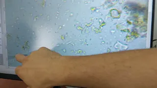 Компост от Калифорнийски червеи, отвара от коприва и др. погледнати под микроскоп