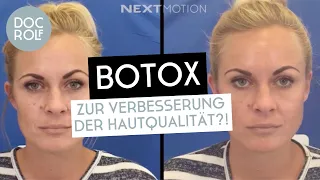 BOTOX BEHANDLUNG für VERBESSERTE HAUTQUALITÄT?! Dr. Rolf Bartsch