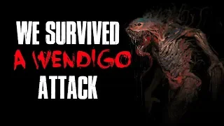 "We Survived A Wendigo Attack" Creepypasta