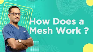 Why the Hernia Mesh Is ESSENTIAL For Hernia Treatment | Dr. Deepak Subramanian