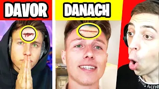 ClashGames reagiert auf 5 YOUTUBER die OPERIERT wurden! 🤕 (iCrimax, Avive, ...)