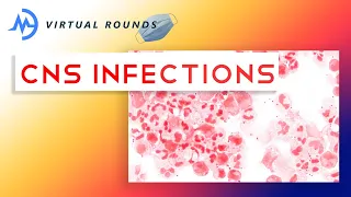 Virtual Rounds Session 17: CNS Infections (Premed Shadowing)