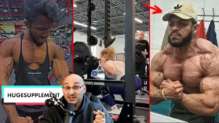 Roids Ruined his Physique