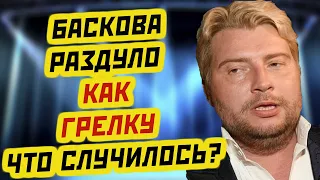 ЗАПУХШИЙ БАСКОВ испытывает серьёзные проблемы со здоровьем