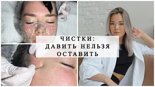 ЧИСТКИ: ДАВИТЬ НЕЛЬЗЯ ОСТАВИТЬ! СТАВИМ ЗАПЯТУЮ ПРАВИЛЬНО☝️ Как избавиться от прыщей? #акне #прыщи