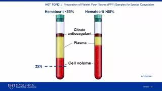 Platelet Poor Plasma Update [Hot Topic]