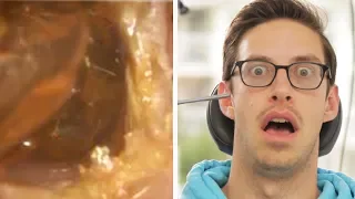 The Try Guys Get Earwax Extractions