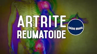 ARTRITE REUMATOIDE | SÉRIE SAÚDE BRASIL