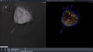 Apoptosis of T685 Human Cancer Cell