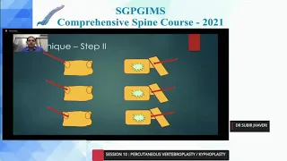 Vertebroplasty & Kyphoplasty, Step by Step Technique, Dr  Subir N  Jhaveri, Consultant Spine Surgeon