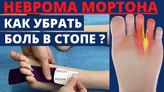 ✅Боль в стопе Неврома Мортона. Тейпирование стопы.