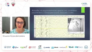 Горчханова З. К., Ельшина О.Д. Неэпилептические состояния при продолженном видео ЭЭГ мониторинге