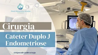 Cateter Duplo J em caso de endometriose | Dr José Alexandre Araújo