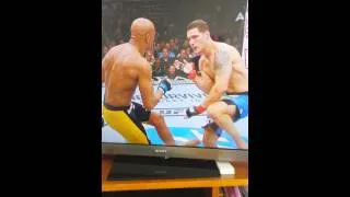 Anderson Silvas leg break