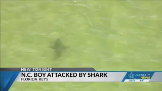 10-year-old loses part of his leg after shark attack in Florida Keys: reports