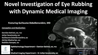 Investigating Eye Rubbing with Dynamic Medical Imaging