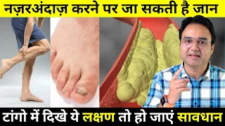 कोलेस्टेरॉल बढ़ने पर सबसे पहले पैरों में दिखते है 5 लक्षण & चिन्ह | Signs of High Cholesterol in Legs