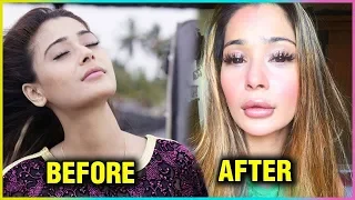 Sara Khan Plastic Surgery GONE WRONG Drastically!