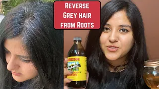 Black Hair Permanently | Reverse Grey Hair Naturally | Ayurvedic Turai Oil | Premature Greying