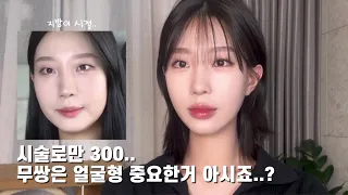 ✨지금까지 했던 시술 총 모음✨ ( +비추천❌, 추천 시술⭕️ , 볼패임 스트레스 있는 사람 다 모여 !!!)