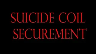 Suicide Coil Securement