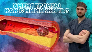 У МЕНЯ ТРОМБ: КАК ЖИТЬ ДАЛЬШЕ?