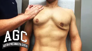 Gyno Surgery with Loose Skin After Massive Weight Loss – A Gynecomastia Removal "Experiment"