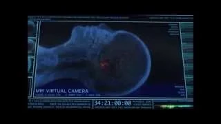 The Walking Dead Brain Scan Scene