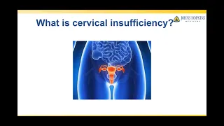 Treatment of Cervical Insufficiency