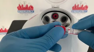 Centrifuge tutorial. Great for nurse, phlebotomists and lab technicians