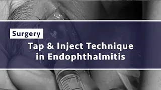 Vitreous Tap and Inject for MK-related Endophthalmitis