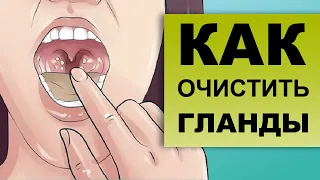 КАК ПРОМЫВАТЬ ГЛАНДЫ