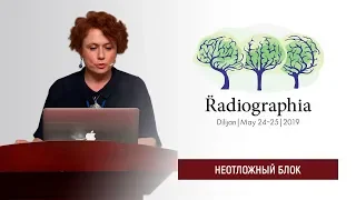 Ольга Беленькая. Острый коронарный синдром —  как выявить не коронарные причины