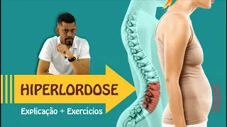 Hiperlordose  - O que é?  | Vídeo c/ exercícios para a postura e para evitar a barriga pra frente