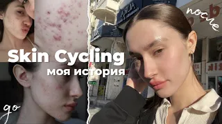 КАК Я ИЗБАВИЛАСЬ ОТ ПРЫЩЕЙ ЗА МЕСЯЦ | Skin Cycling