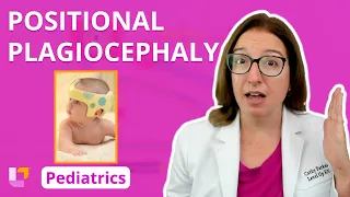 Positional Plagiocephaly: Musculoskeletal Disorders - Pediatric Nursing | @LevelUpRN