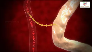 Tubular Reabsorption 3D Animation| reabsorption or tubular reabsorption