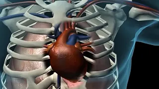 Diagnosing Heart Failure with NT-proBNP